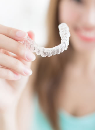 clear aligners